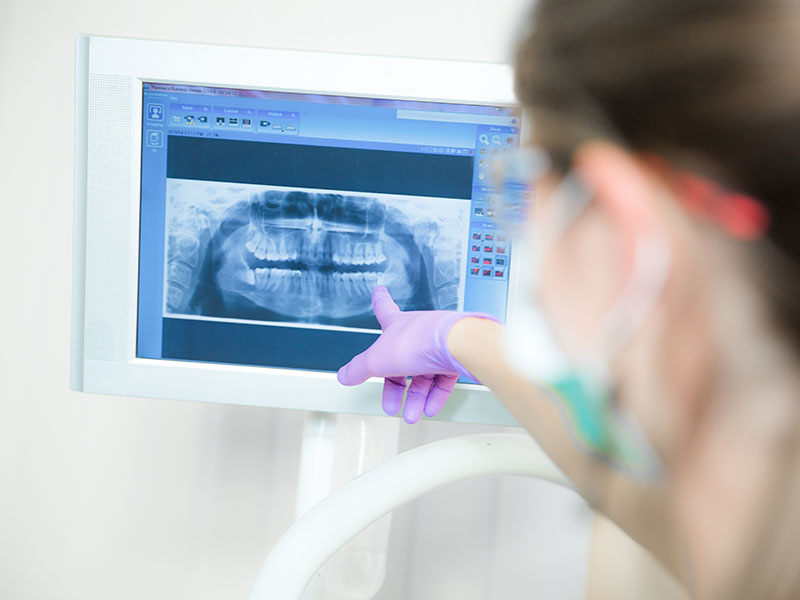 Digitales Röntgen - Zahnheilkunde Lohmar